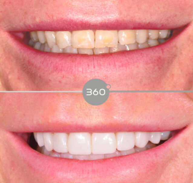 360 Dental