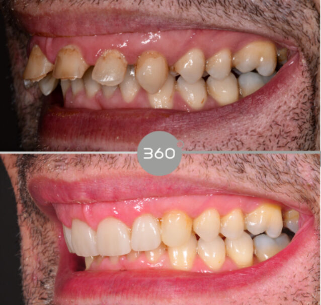 360 Dental