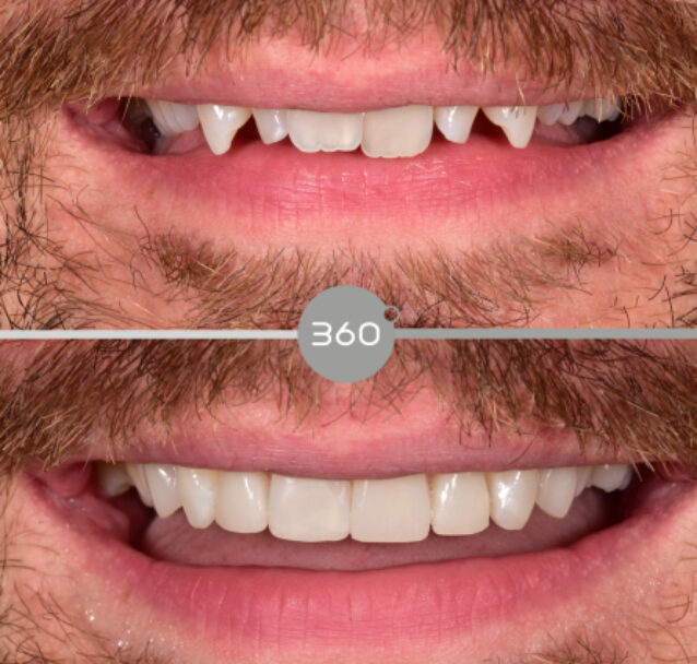 360 Dental