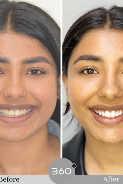 Cheadlehulme Dental