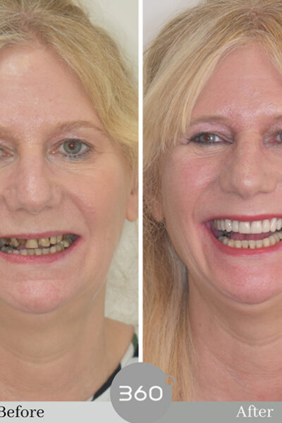 Cheadlehulme Dental