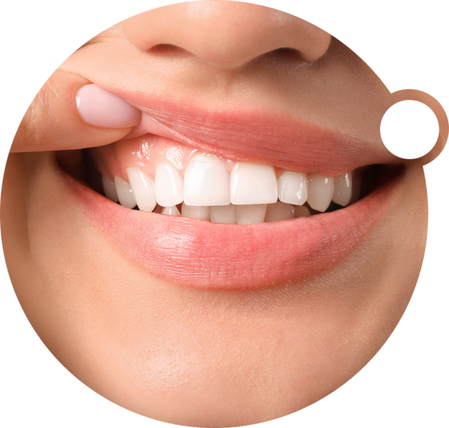 Treatment - 360 Dental