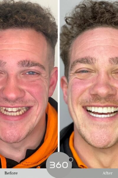 Cheadlehulme Dental
