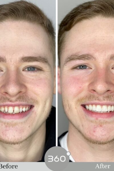 Cheadlehulme Dental