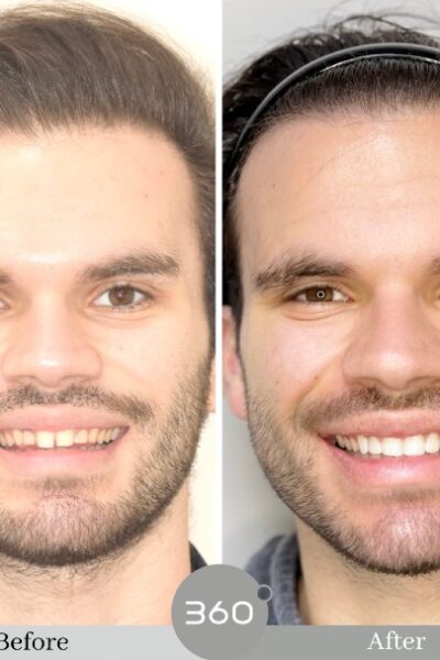 Cheadlehulme Dental