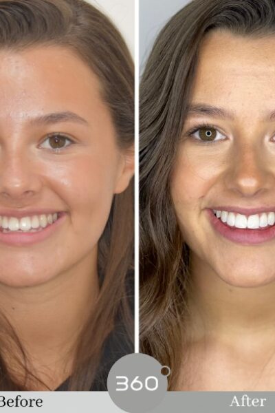 Cheadlehulme Dental