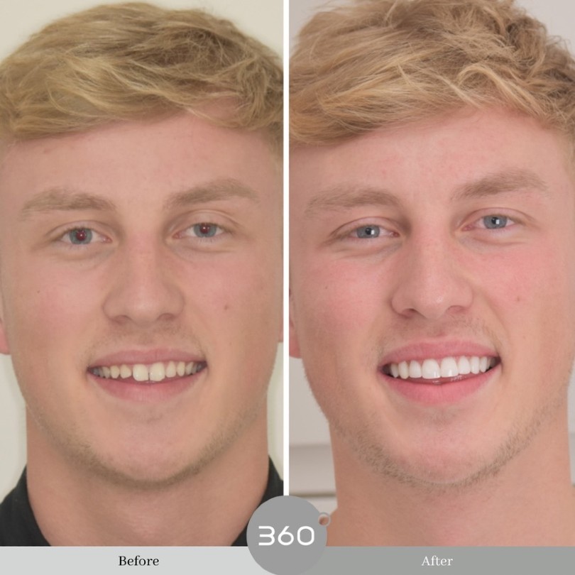360 Dental